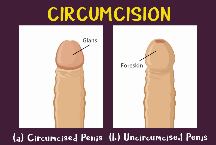 Circumcised Or Uncircumcised Penis 27